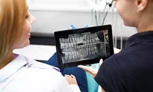 Two woman look at the tooth picture on a tablet at dentist office